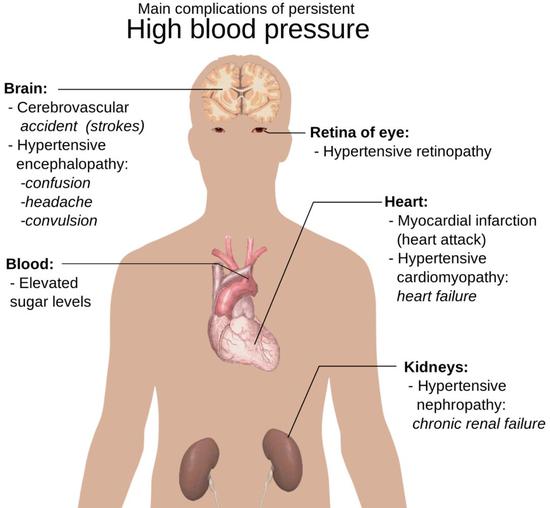 高血压影响的器官真不少（来自pixabay.com）