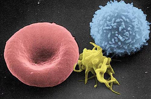 电镜下的 T细胞（右），旁边是红细胞和血小板。| 图片来源：Wikipedia