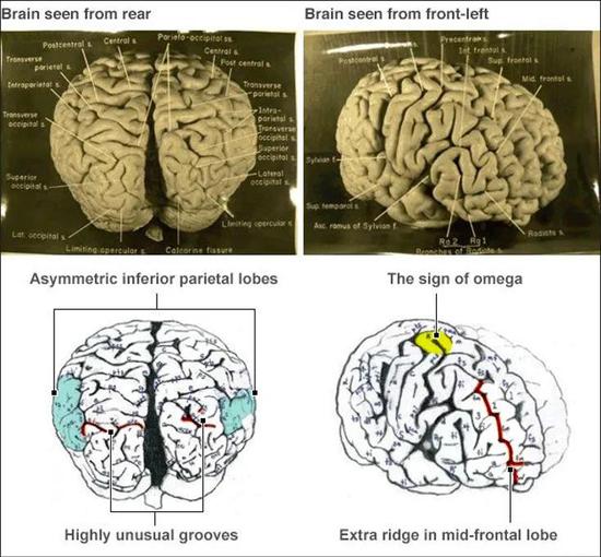 一些研究中爱因斯坦大脑的不同 图源：BBC