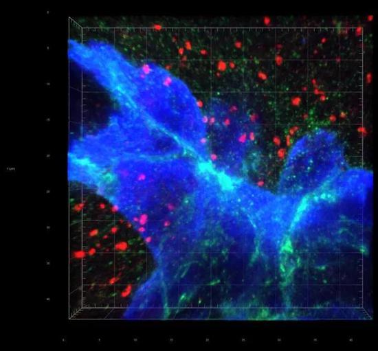  ▲乳腺癌细胞（蓝色）会与分泌神经递质的神经元（红色）形成突触结构（图片来源：W。 Jiao and Q。 Zeng， EPFL）