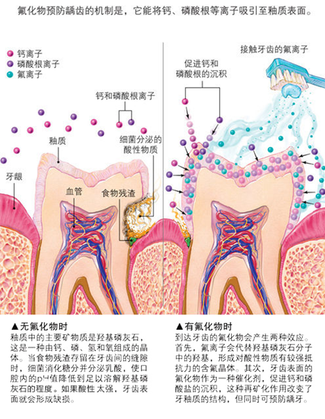 含氟牙膏对牙齿的作用