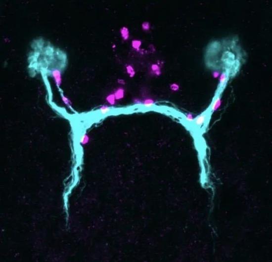 显微镜下的视觉神经轴突/感光细胞神经元（青色）与路标细胞（紫红色）（图片来源：Lucila Scimone， Whitehead Institute）