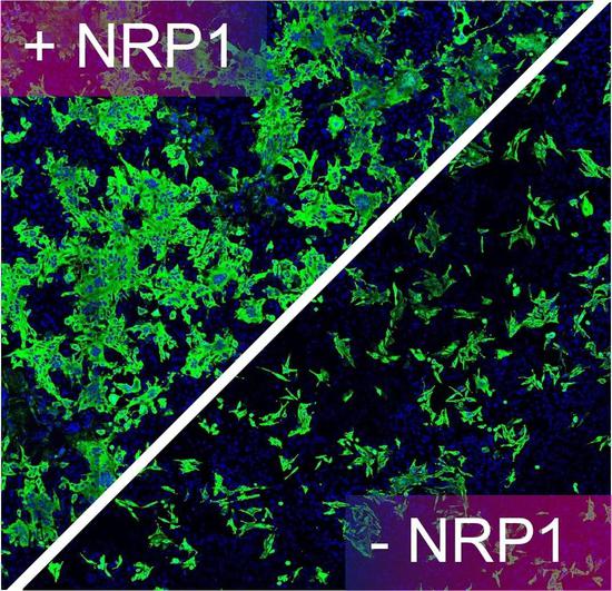 图中绿色的是被新冠病毒感染的人类细胞，在没有宿主因子NPR1的辅助时，病毒的感染性大大降低