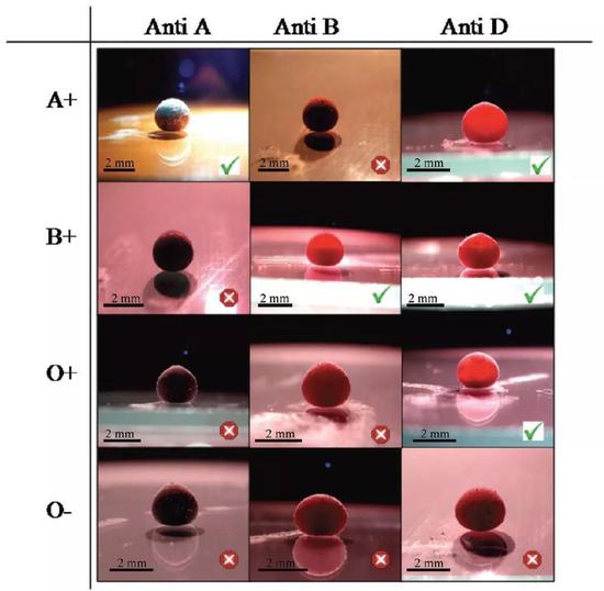  利用液体弹珠来检测血型。图中展示了A+， B+， O+和O-这四种血型血液的液体弹珠分别与A， B和RhD三种抗体混合后的结果。对号表明血液中存在相应的抗原，导致液体弹珠的外观发生显著变化。（图片来源：Tina Arbatan et al。 Advanced Healthcare Materials， 2012， 1， 80）