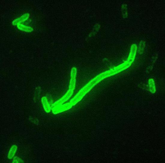 鼠疫杆菌，直接荧光抗体染色 （DFA）， 