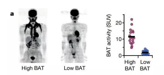 ▲不同人体内的褐色脂肪组织活性各有不同（图片来源：参考资料[1]）