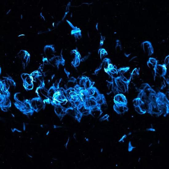 ▲在小鼠帕金森病模型的神经元中，α-突触核蛋白聚集成的路易小体（图片来源：Oregon Health & Science University）