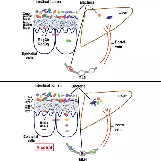 ▲酒精会让一些肠道菌群跑到肝脏生长（图片来源：参考资料[4]）