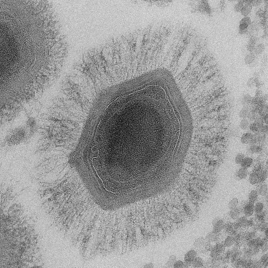 图示拟菌病毒为几年前才发现的一种巨病毒。（图片来源：JP Baudoin and D Brahim Belhaouari,IHU Mediterranee Infection）