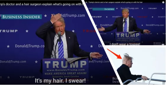 图片来源：https：//www.businessinsider.com/trump-bald-spot-revealed-video-hair-transplant-2018-2