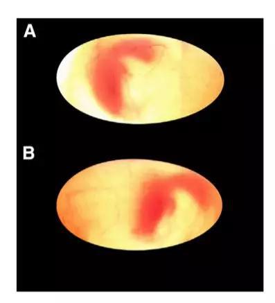 ▲经过处理的乌龟蛋，胚胎会停留在靠近中间的位置（上图）。没有经过处理的乌龟蛋，胚胎会前往其他位置。图中为前往了温度较高的一端（下图）（图片来源：参考资料[1]）