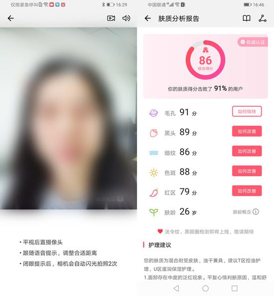 ▲荣耀Magic2：肤质检测
