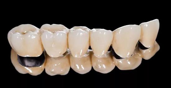 人类牙齿（图片来源：视觉中国）