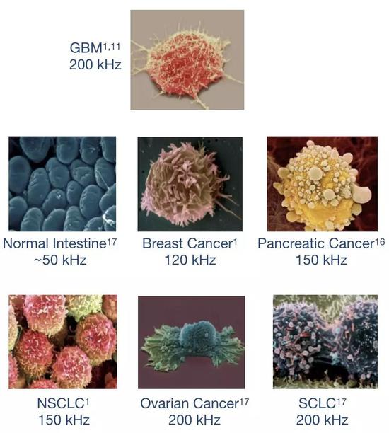 ▲ 不同的细胞类型对应不同频率的交变电场