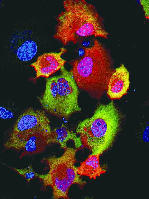 《自然—生物技术》11月刊封面图片，它显示了利用荧光RNA可对单细胞中mRNA的翻译过程进行定量研究。