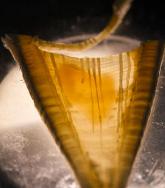 显微镜下鲨鱼脊骨所含有的组织层 （图片来源/TomKleindinstvia BBC）