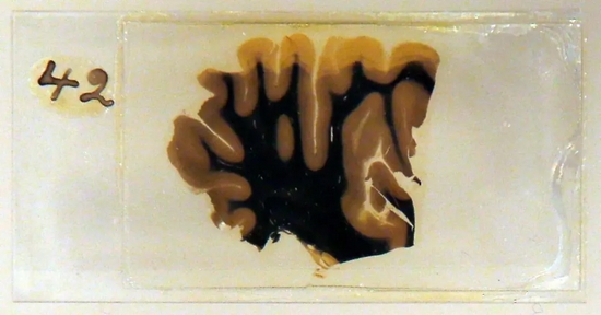 2012年3月27日，爱因斯坦的大脑玻璃切片在伦敦韦尔科姆收藏馆（Wellcome Collection）展出。