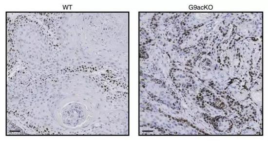 ▲缺乏G9a的小鼠，肿瘤更具侵袭性（右）（图片来源：参考资料[1]）