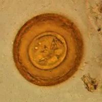 Alex定期服下的缩小膜壳绦虫卵。图片来源：Wikipedia。