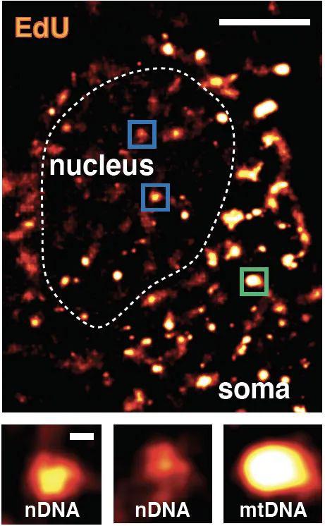 ▲在这个神经元的细胞核中，亮点显示的是集中修复的位点（Credit：Salk Institute/Waitt Advanced Biophotonics Center）