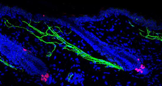 ▲红色显示了毛囊底部的黑素干细胞，周围有绿色显示的交感神经（版权：Bing Zhang和许雅捷）