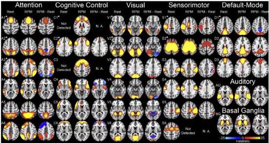 推理过程中不同神经行为由不同脑区控制。在静息状态和瑞文矩阵测试(RPM：Raven Progressive Matrices，常用于测试抽象推理能力)条件下29个神经网络：注意神经网络6个(A1 A6)，认知神经网络6个(C1 C6)，视觉神经网络6个(V1 V6)，感觉运动神经网络6个(S1 S6)，默认神经网络3个(D1 D3)，听觉神经网络(AU)，基底节区神经网络(BG)。在瑞文测试中，神经网络在休息期间的空间分布和性能被绘制成统计数据，暖色和冷色分别标记了在任务期间内在网络一致性显著增加和减少的区域。引自：http://dx.doi.org/10.1016/j.neuroimage.2014.09.055