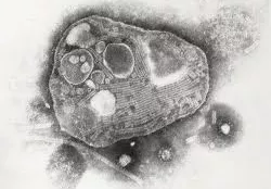 牛瘟病毒。图片来源：wikipedia
