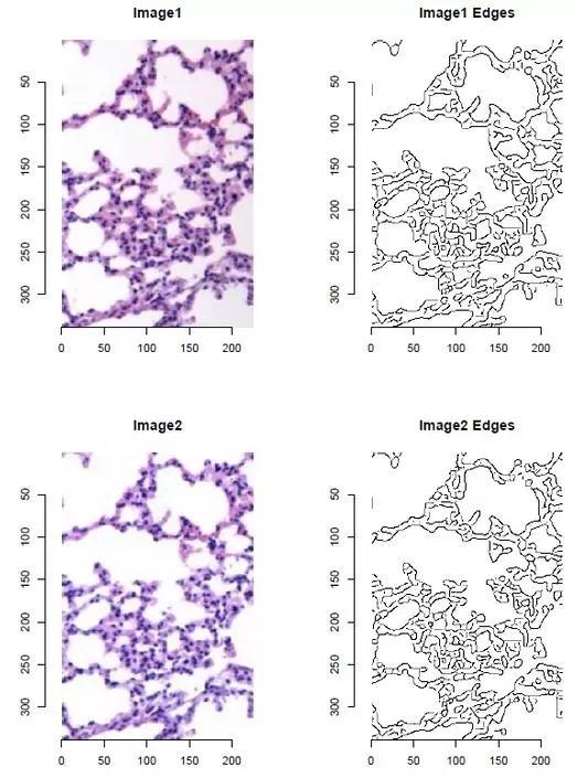 中国医科院Nature最新论文被指一图多用