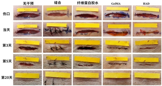 多种方法处理皮肤切割伤的对比图