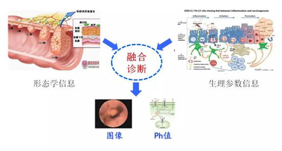 在肠胃病中，轻微的息肉或炎症逐步加重甚至恶化为肿瘤等疾病是有一个过程的，转化过程中病变位置的形态、人体的分泌物质或局部微生态环境都存在差异，那么选择合适的生理参数传感器（如pH、温度或含氧量等传感器）结合图像传感器实现多重信息的融合诊断将会是一大跨越。