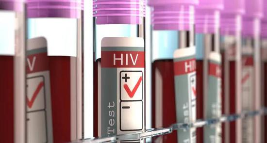 　至今仍无有效办法治愈HIV | Heart.org