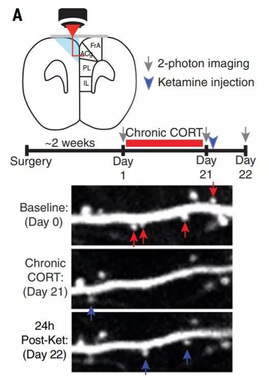 ▲在氯胺酮治疗后，一些树突棘（组成突触的一部分，蓝色箭头所示）开始恢复（图片来源：参考资料[1]）