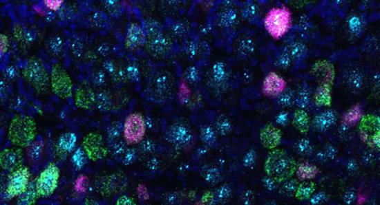 小鼠膀胱的感觉神经元（洋红色）表达机械感受器PEIZO2蛋白（青色）