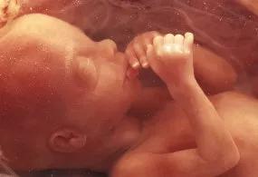 12周大的真实胎儿