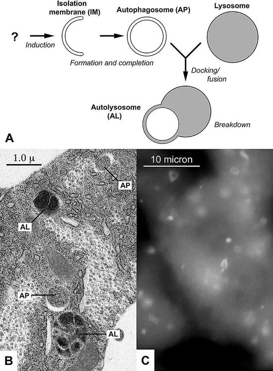  图A展示了自噬的过程，图B，C分别在组织切片和荧光层面展示了自噬体。图片来源：Wikipedia