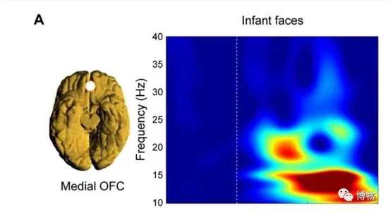 看到动物幼崽时的大脑活动区域 图片来源：Morten L。 Kringelbach等