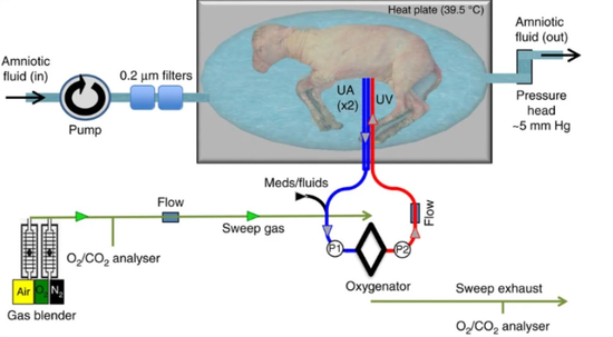 弗雷克设计的系统中，山羊胎儿被人造羊水包围在聚乙烯薄膜袋中，通过脐带接口连接气体交换系统，形成封闭的流体人造环境