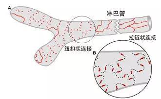 淋巴管上的纽扣状连接与拉链状连接示意图。图片来源：修改自参考文献[2]。