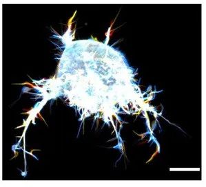 ▲丝状伪足对细胞的存活和发育非常重要（图片来源：参考资料[1]，credit：Niels Bohr Institute / University of Copenhagen ）