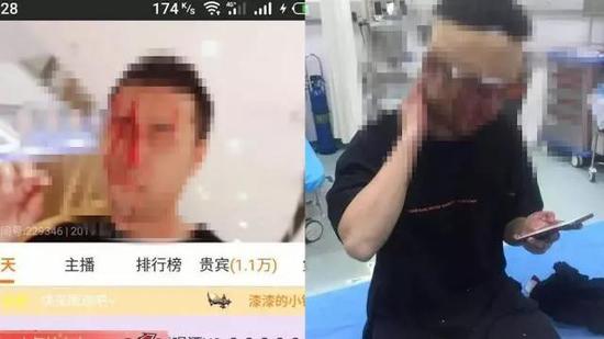 一场互联网“猎巫运动”:女主播扔猫记 国内也有过主播受到袭击的事件