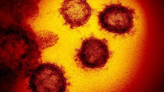 新型冠状病毒（图片来源：美国国家过敏和传染病研究所落基山实验室）