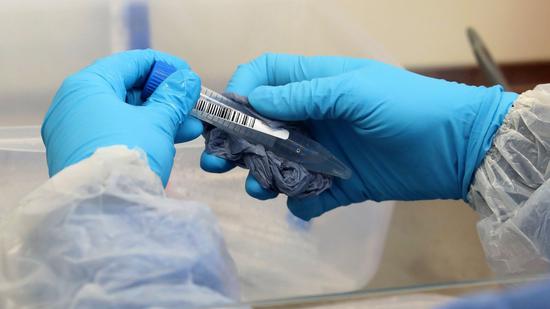 英国最大检测实验室暴发疫情，被指违反安全规定