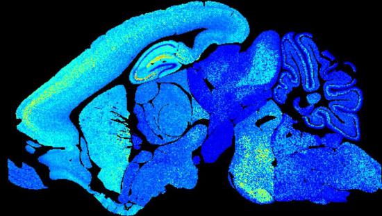 ▲成年小鼠（上图）的大脑中，突触的类型更丰富；幼年小鼠（下图）的大脑中，突触的多样性较低（图片来源：考资料[2]；Credit： Seth Grant University of Edinburgh）