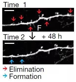  ▲在小鼠形成和消除恐惧记忆的过程中观察神经元树突棘结构变化（图片来源：参考资料[2]）