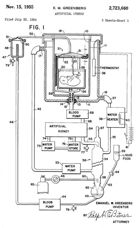 1955年的人工子宫模型专利 图源：美国专利商标局