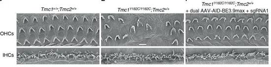  ▲双AAV递送的单碱基编辑器让Tmc1突变小鼠的内耳拥有了形态正常的毛细胞（图片来源：参考资料[1]）