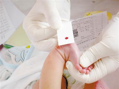 新生儿采足跟血检测遗传性耳聋。