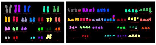 左图为正常的染色体；右图为自噬反应被抑制后，出现异常的染色体（图片来源：Salk Institute）