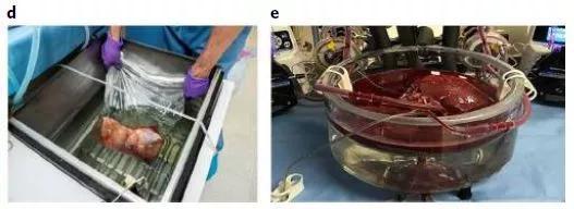 新型技术显著延长人体肝脏体外保存期限 肝移植的福音啊！