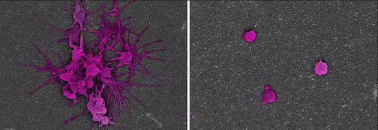 当血小板被激活时，它们会发出长卷须并聚集在一起，从而形成血凝块（左）。当诱饵暴露于相同的血小板刺激分子中，它们不能激活并保持其圆形的“静止”形状（右）。图片来源：哈佛大学威斯学院